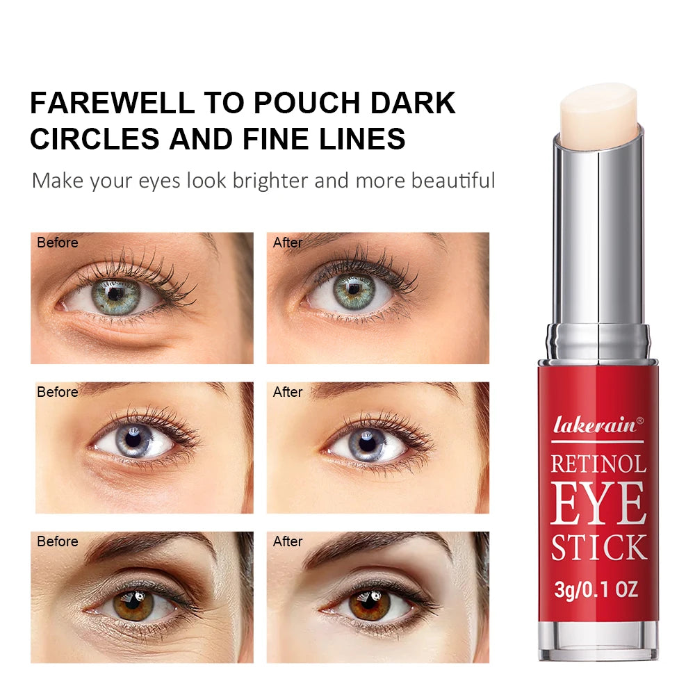 Crema de Ojos Retinol Refrescante™