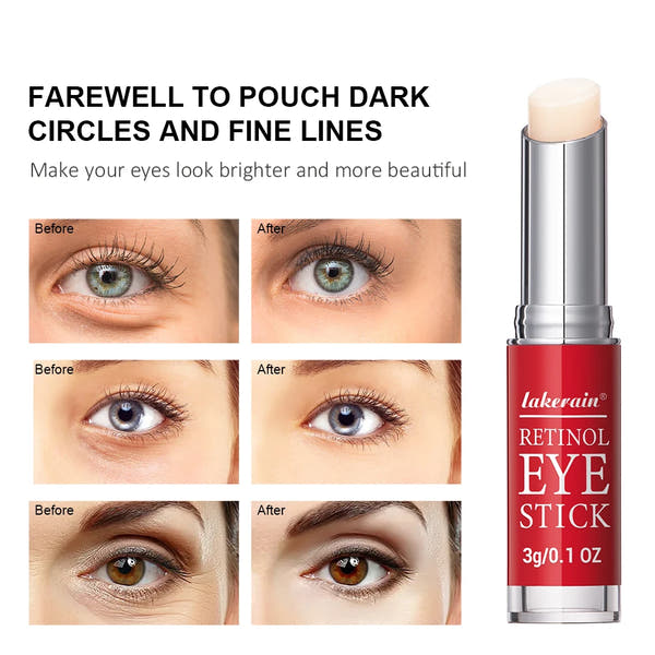 Crema de Ojos Retinol Refrescante™